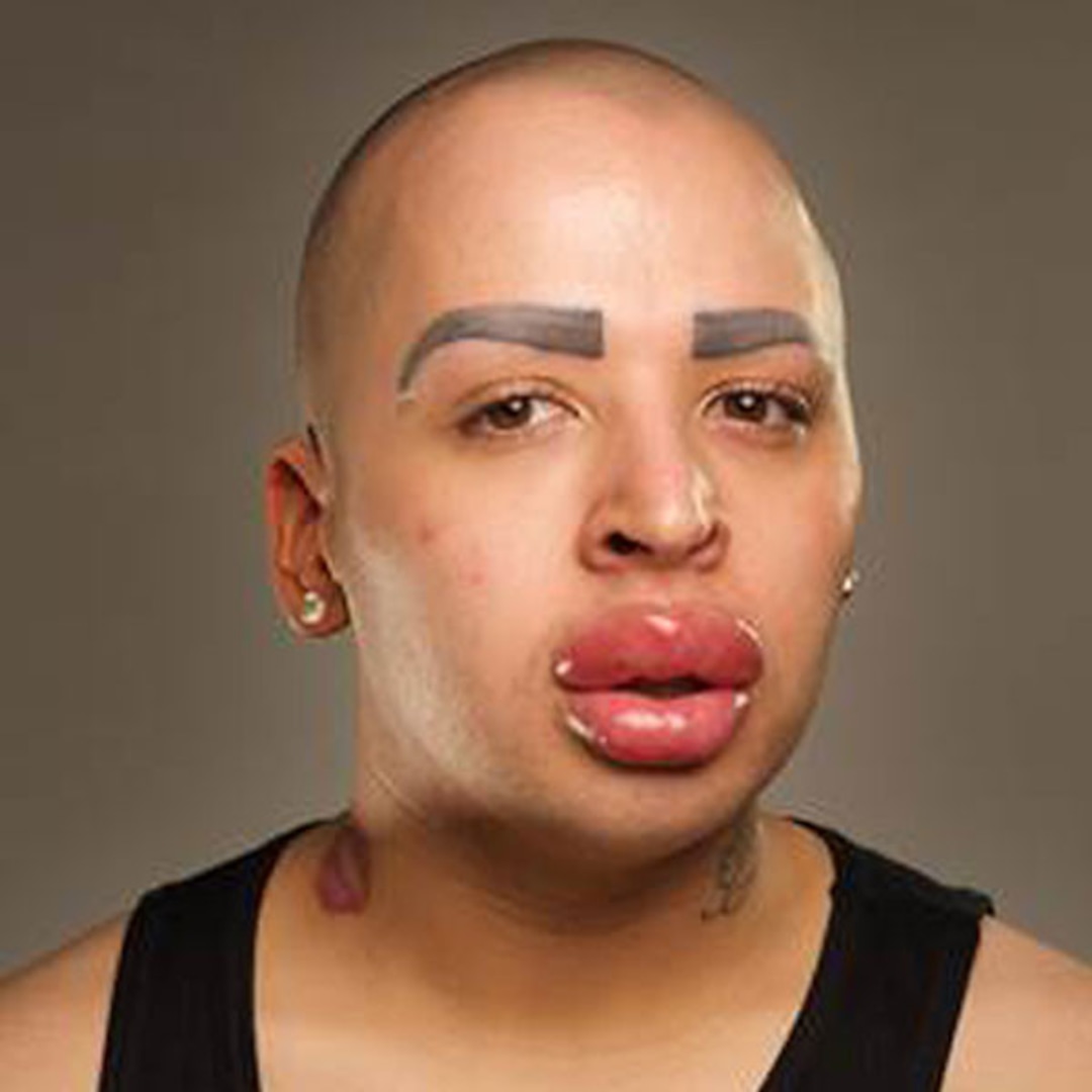 Botched Is Coming Back for Season 2 Very Soon! Get the Scoop!