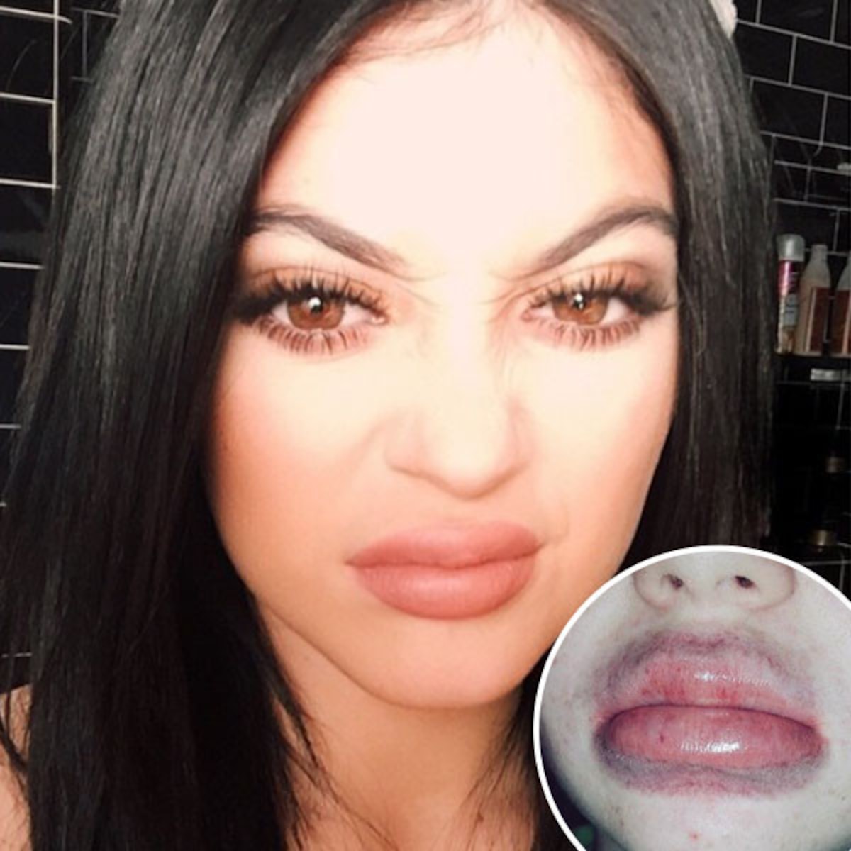 Kylie Jenner Lip Challenge Produces Terrifying Results E Online Kylie Jenner Lip Challenge Produces Terrifying Results E Online