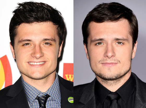 Josh Hutcherson, Deviated Septums