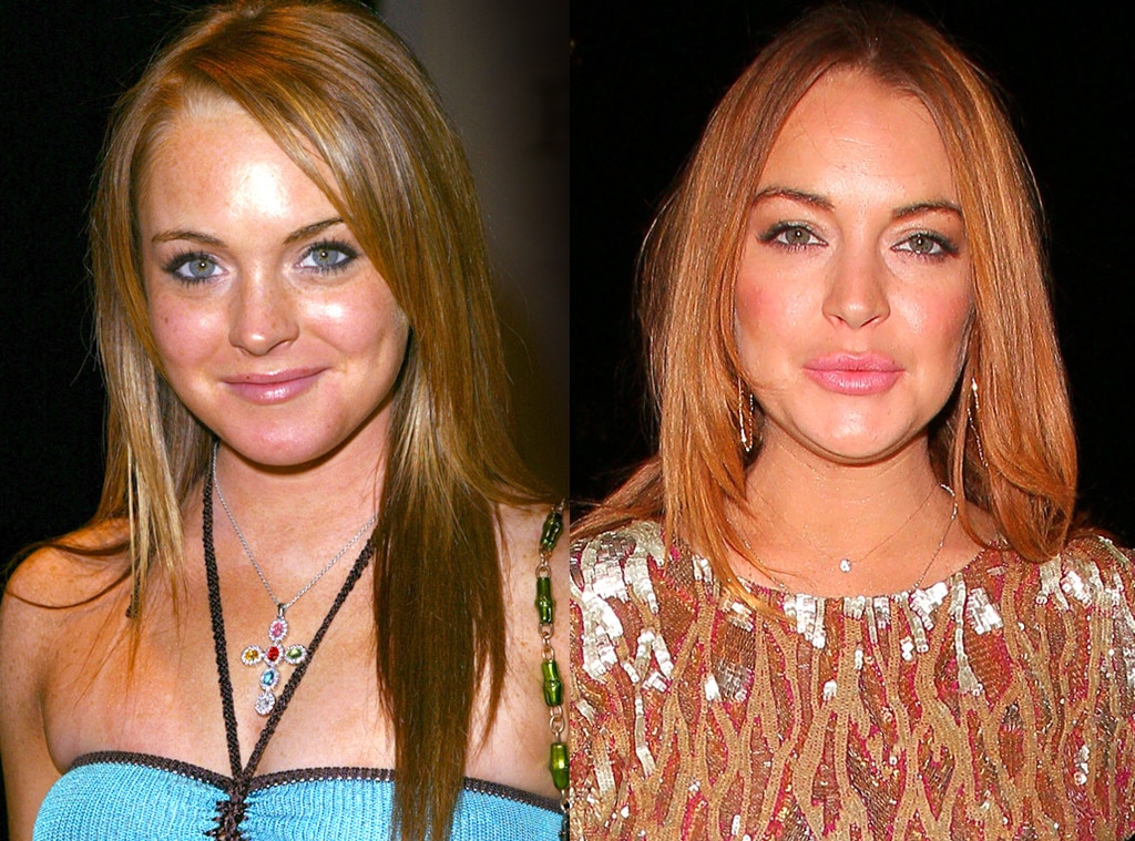 Lindsay Lohan from Celebs Who Deny Getting Plastic Surgery
