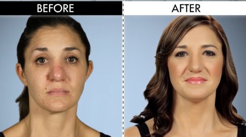See the Shocking Botched Before and Afters! | E! News