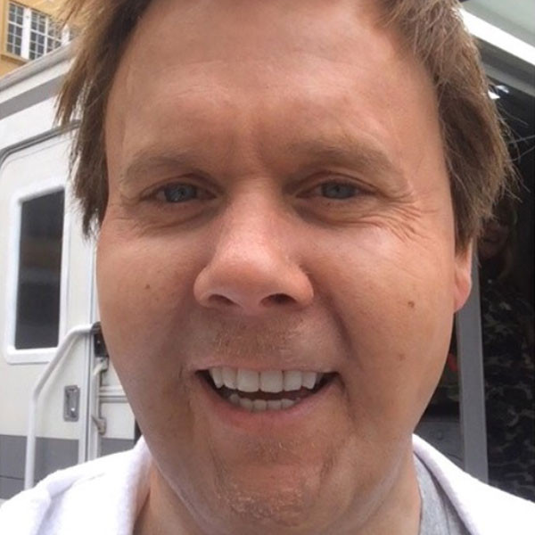 What Happened To Kevin Bacon S Face E Online