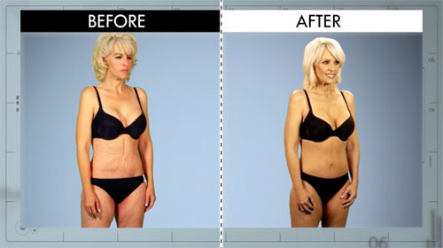 Fotos von VorherNachherBilder von &quot;Botched&quot; Patienten E! Online