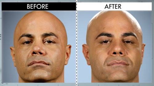 The Boxer From Botched Patients Before And After Shocking Transformations E News 1747