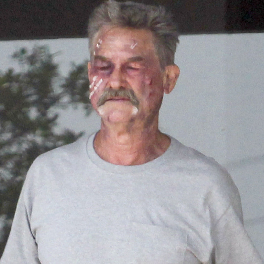 What Happened to Kurt Russell’s Face?!