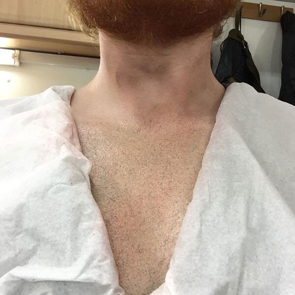 Ed Sheeran Reveals He Was Joking Again About the Lion Tattoo on His