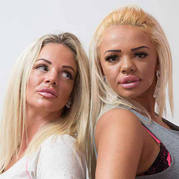 Mom Daughter Duo Drop 80 000 On Plastic Surgery Together E Online