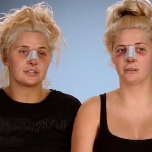 Shannon Twins Drink While On Pain Meds Watch The Botched Clip E   Rs 300x300 151006105151 Shannon Twins 