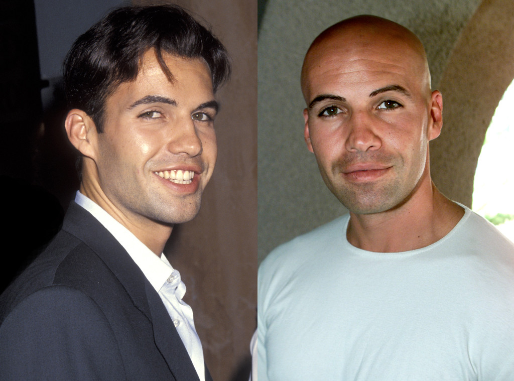 What These Bald Stars Looked Like With Hair | E! News