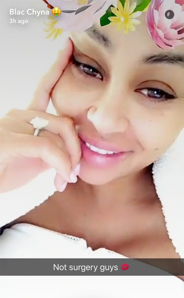 Blac Chyna Denies Weight Loss Surgery After Giving Birth To Dream E News Uk