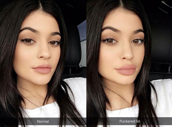 Kylie Jenner's Lip Filler Isn't the Only Secret to Her Famously Plump ...