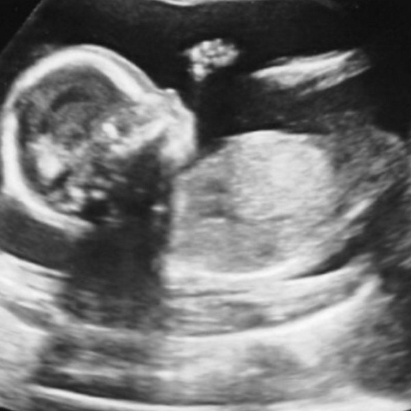 april fools fake sonogram april fools fake sonogram