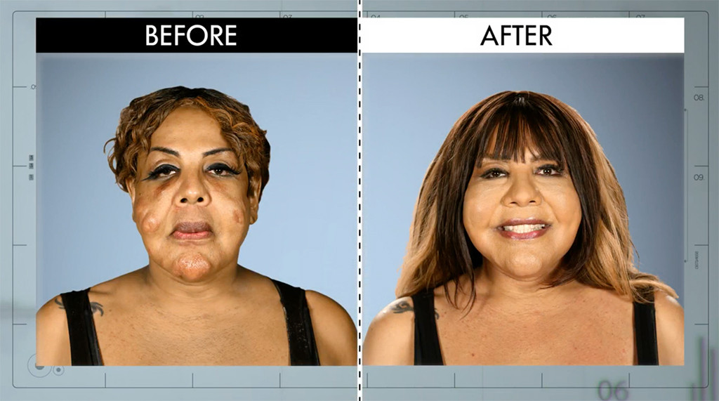 Concrete in Her Face from Botched Patients Before and After—Shocking