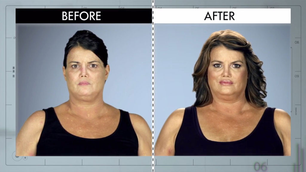 Photos From Botched Patients Before And After Shocking Transformations ...