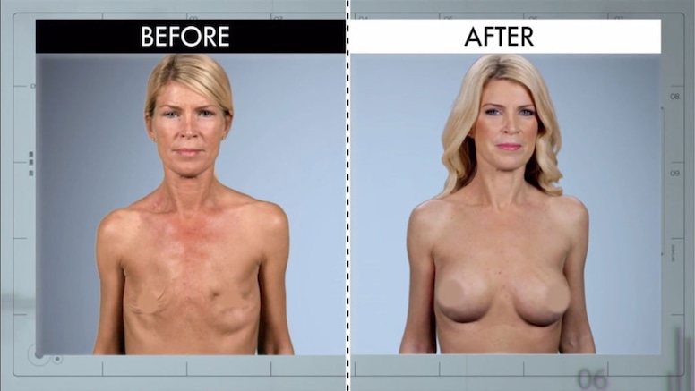 Botched Transformations