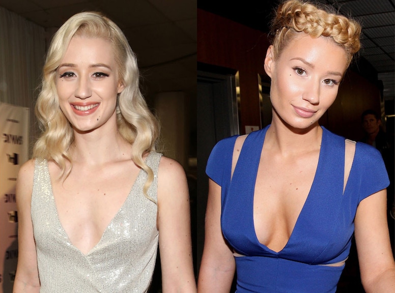 Iggy Azalea, Plastic Surgery, Before and After