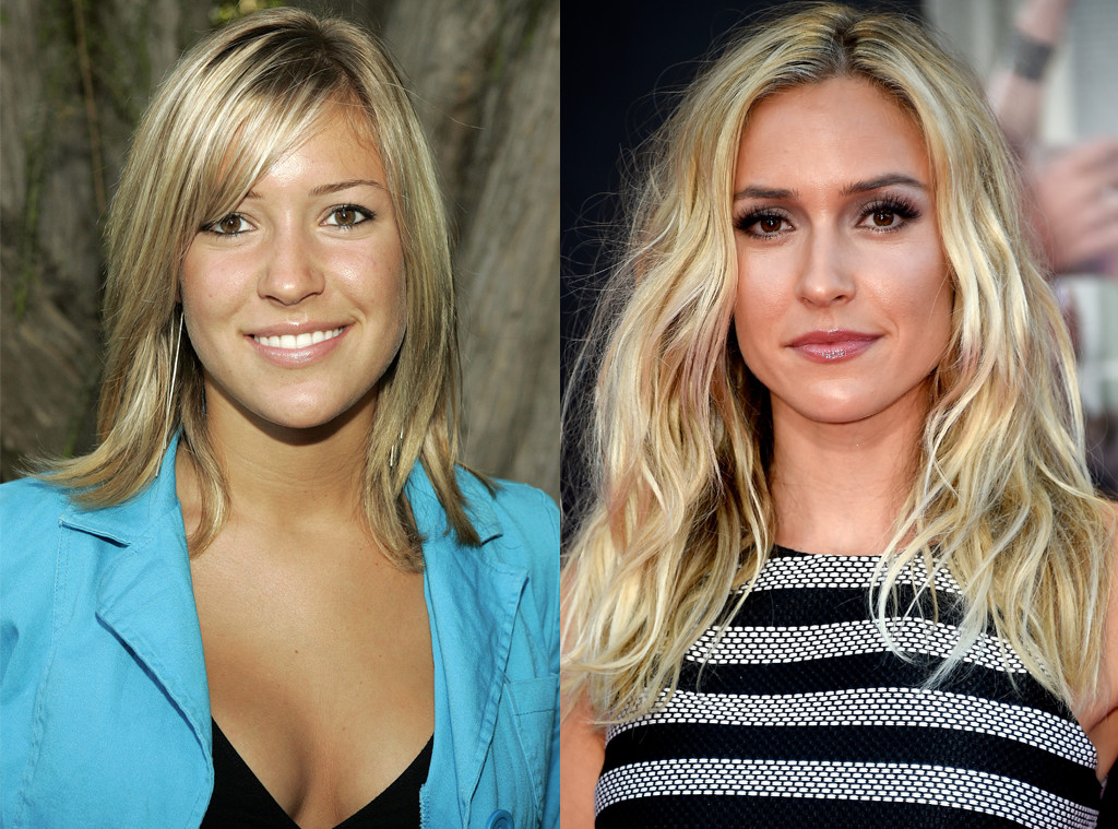 Photos from The Hills Then and Now: What the Stars Look Like 10 Years Later