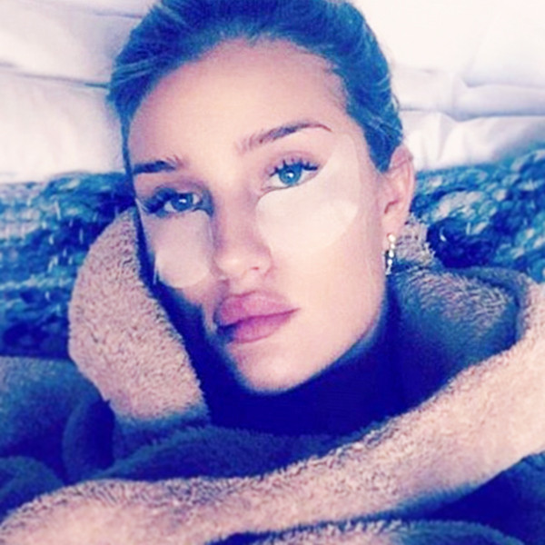 Are UnderEye Bags Aging You? Read This!