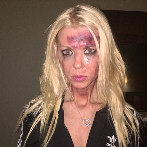 Tara Reid Appears Bloodied And Bruised E Online