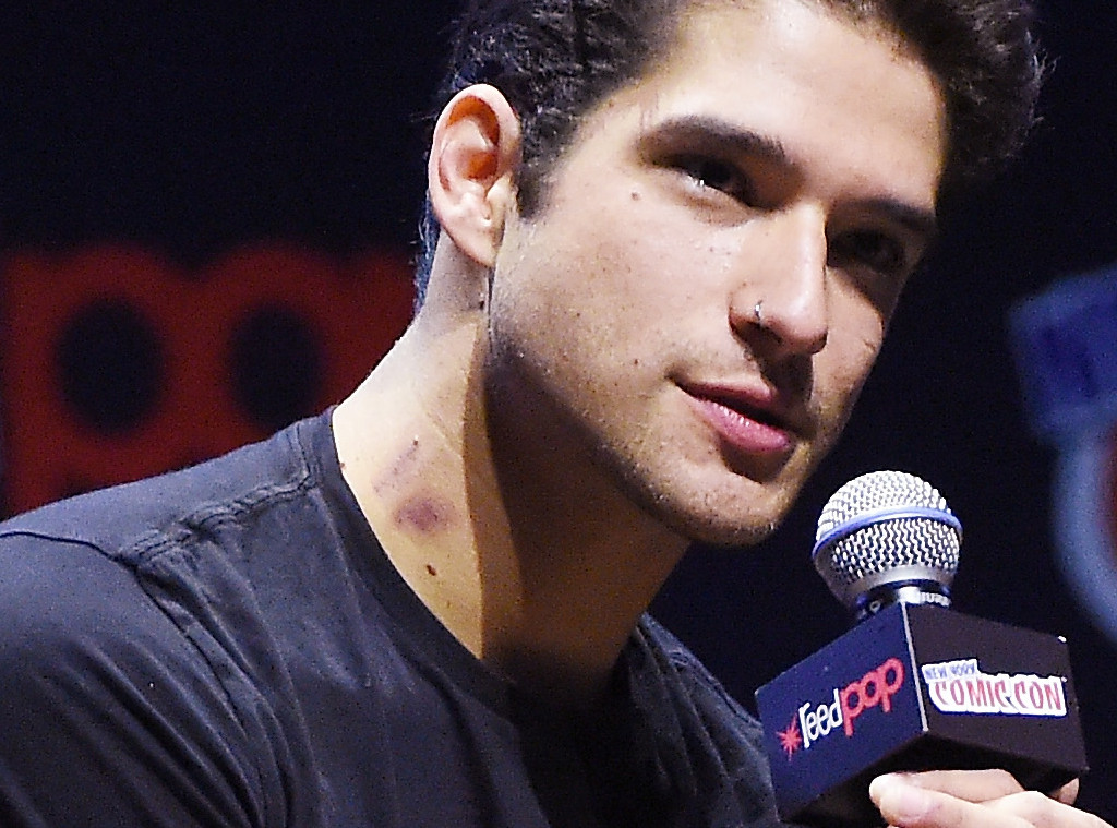Tyler Posey Does Not Hide His Hickeys From Bella Thorne E Online