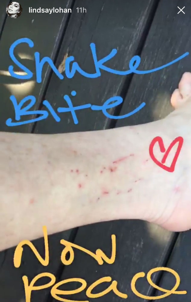 Lindsay Lohan, Snake Bite