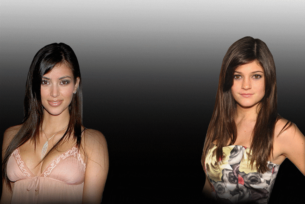 Kylie Jenner Plastic Surgery Before : Unveiling the Astonishing Transformation