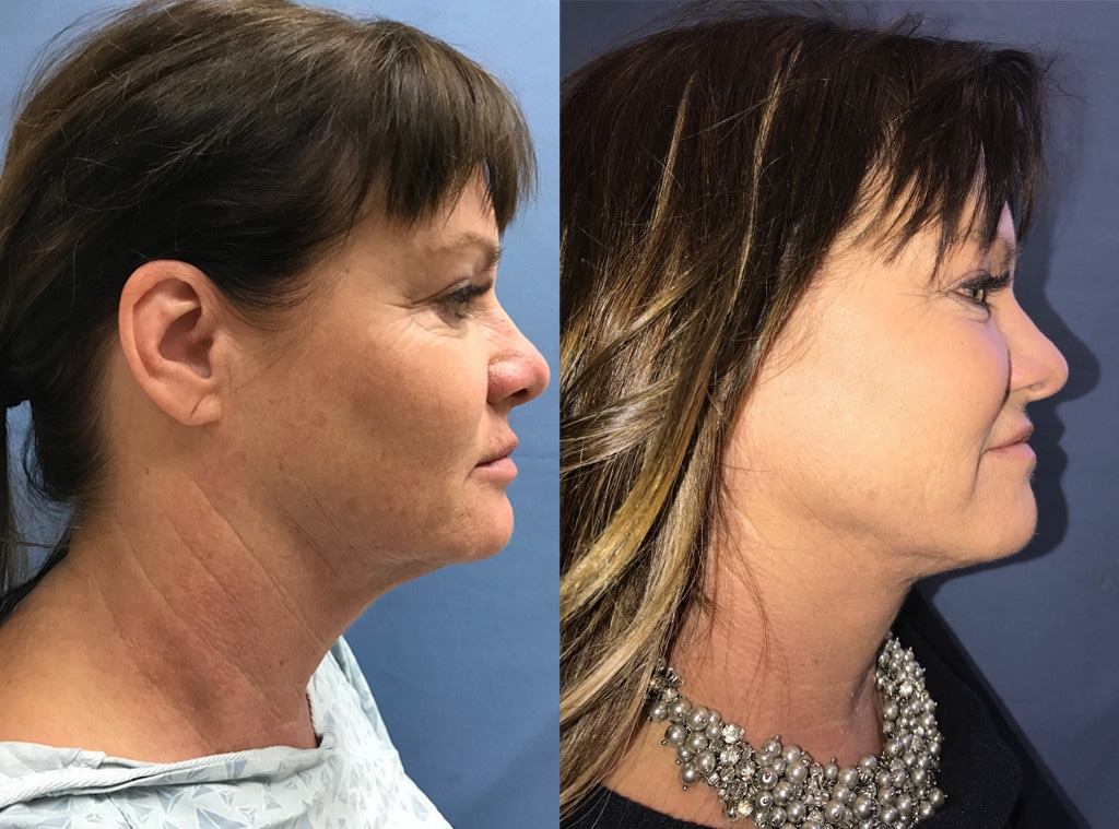 Jeana Keough, Dr. Thomas