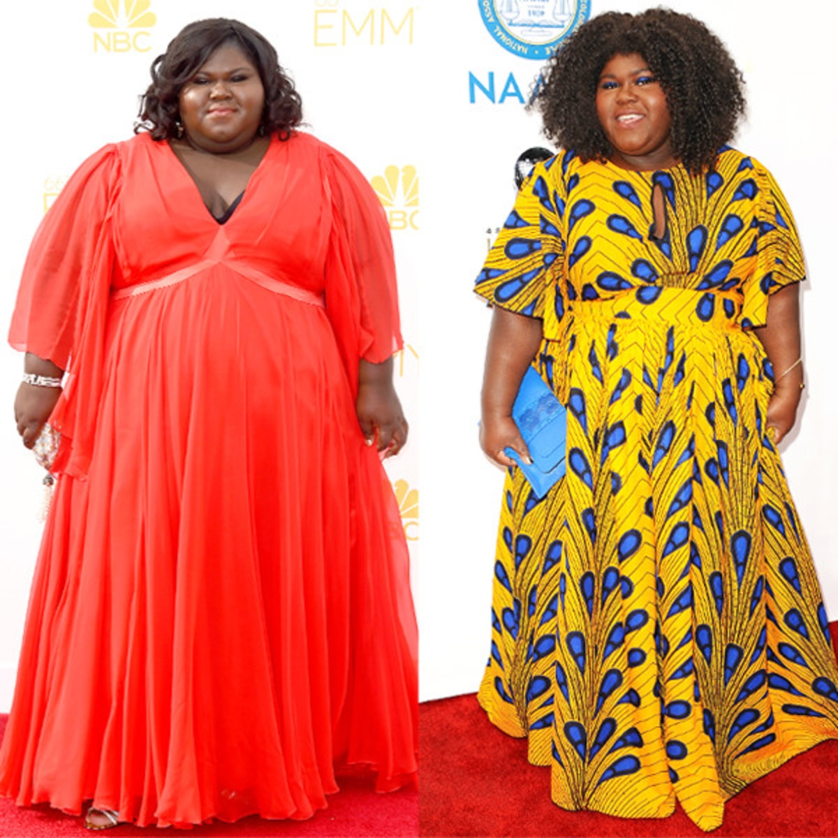 Gabourey Sidibe Opens Up About Secret Weight Loss Surgery E Online Gabourey Sidibe Opens Up About Secret Weight Loss Surgery E Online