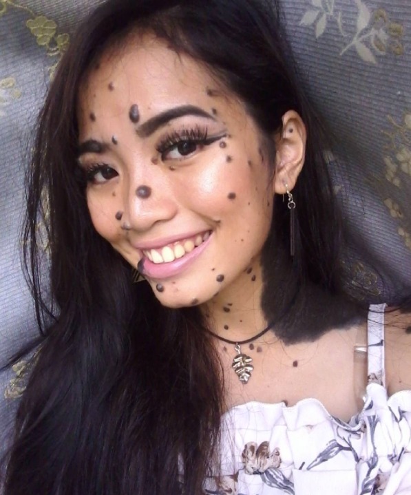 ¿Qué enfermedad tiene la mis universo?