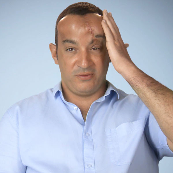 Botched's Dr. Nassif Expands Patient's Head to Fix Severe Scar E
