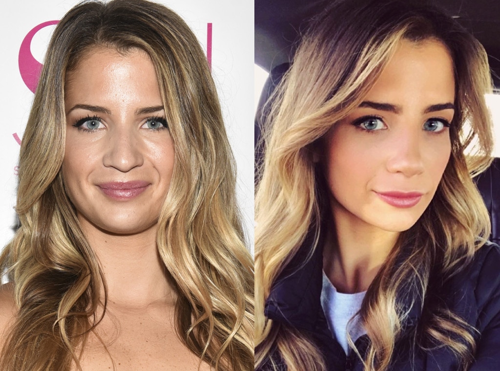 Naomie Olindo, Nose Job