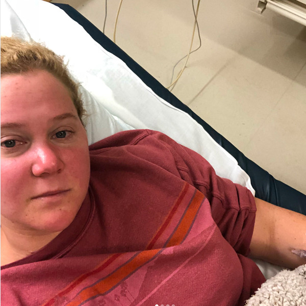 Amy Schumer Hospitalized for Horrible Kidney Infection