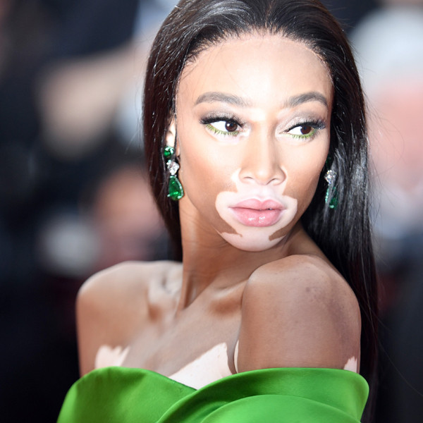 Winnie Harlow Just Wore the Most Gorgeous Fishnet Dress With