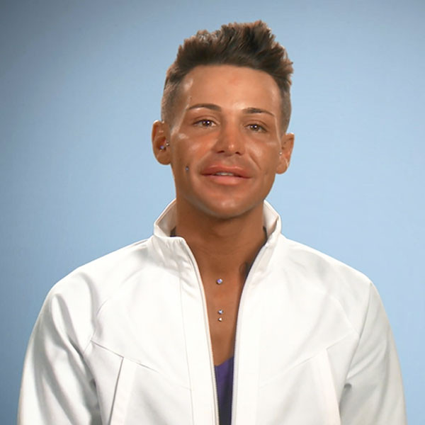 Botched Patient And Self Described Plastic Surgery Enthusiast Needs Dr Dubrow And Dr Nassif To 