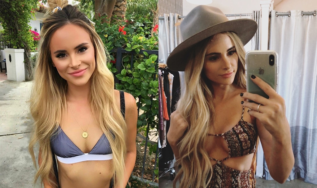 Bachelor Nation's Amanda Stanton Blogs About Breast Augmentation - E! Online Bachelor Nation's Amanda Stanton Blogs About Breast Augmentation - E! Online
