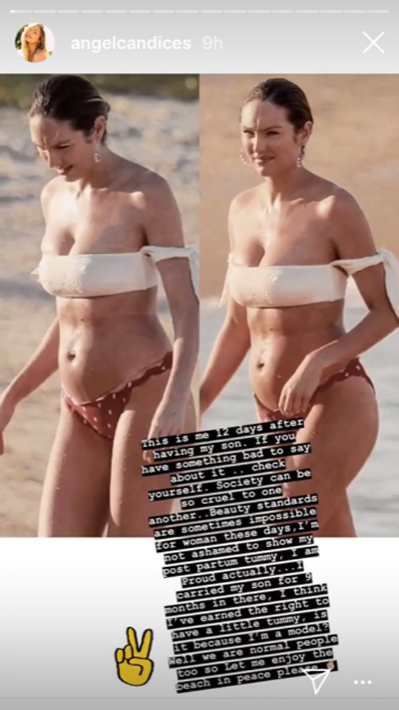 Candice Swanepoel wows in sexy bikini & flashes her bum in black