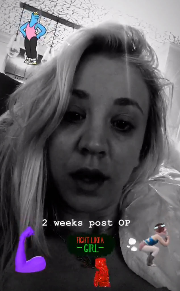 Kaley Cuoco Hits the Gym Two Weeks After Shoulder Surgery ... Kaley Cuoco Hits the Gym Two Weeks After Shoulder Surgery ... - 634 x 1022 jpeg 53kB
