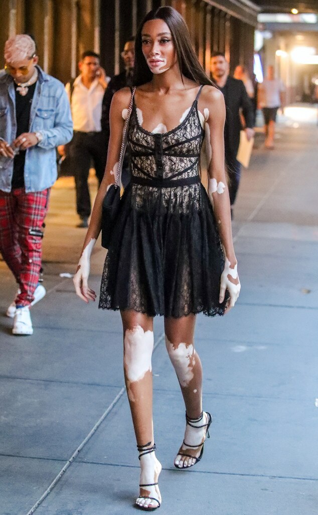ESC: Best Dressed, Winnie Harlow