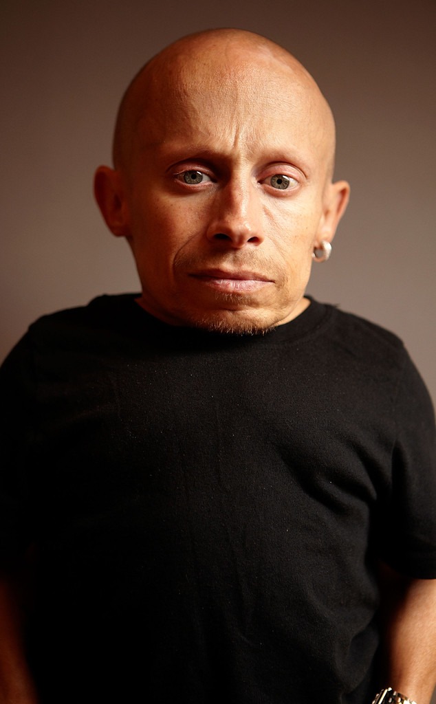 Verne Troyer