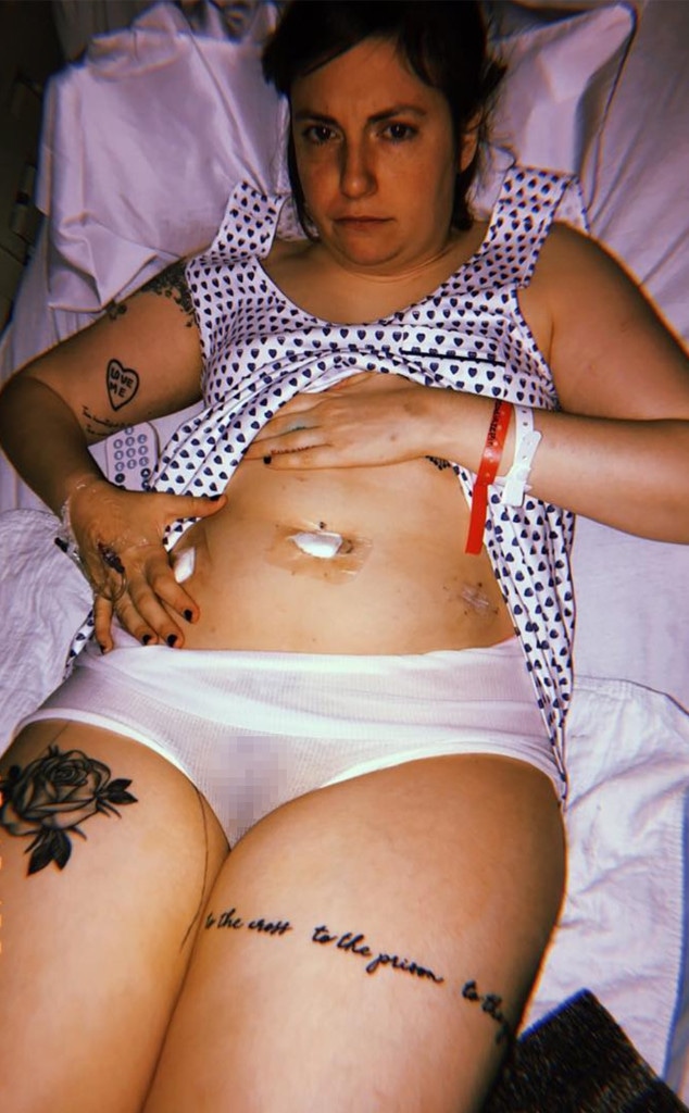 Lena Dunham, Surgery