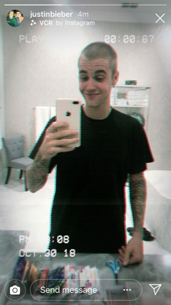 Justin Bieber, Shaved Head