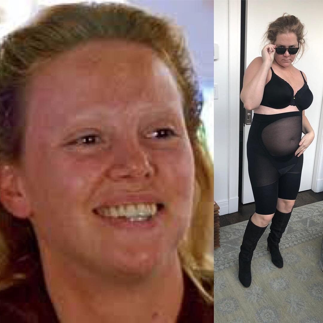 Amy Schumer, #10YearChallenge 