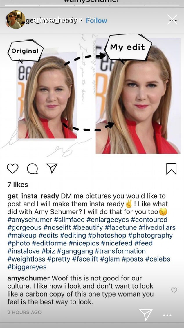 Amy Schumer, Photo Edit