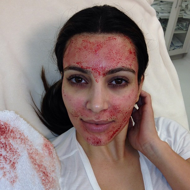 Kim Kardashian, Instagram, Vampire Facial