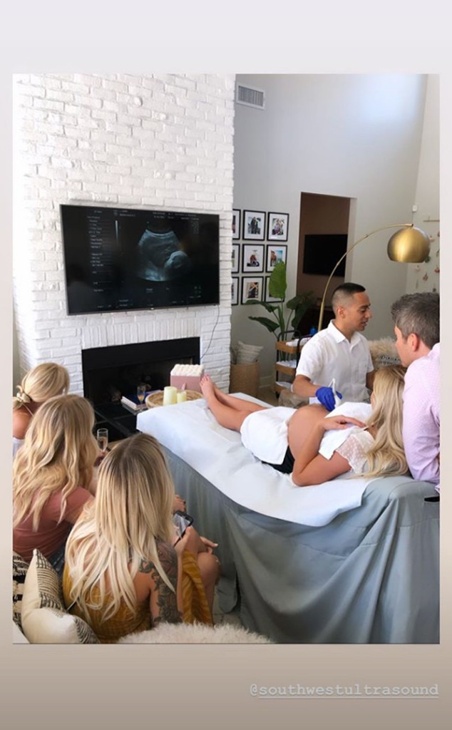 Arie Luyendyk Jr.'s Wife Lauren Gets Ultrasound at Baby ...
