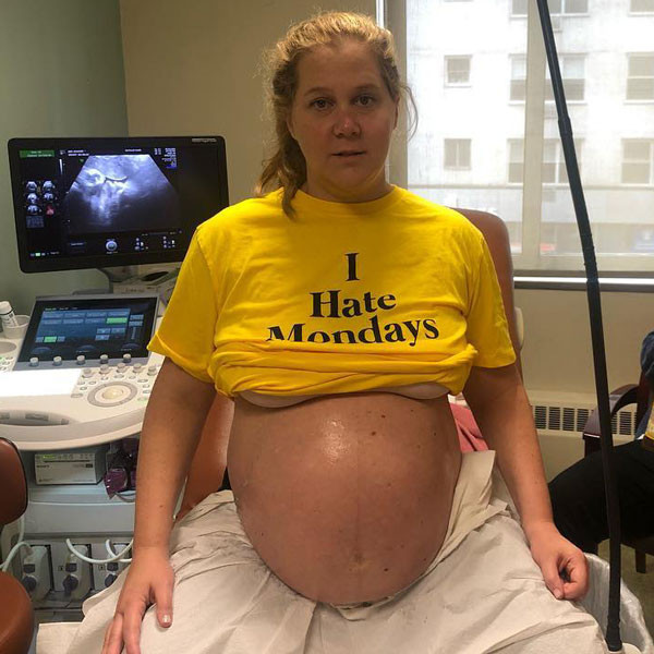 Even Amy Schumer Can T Believe She S Still Pregnant