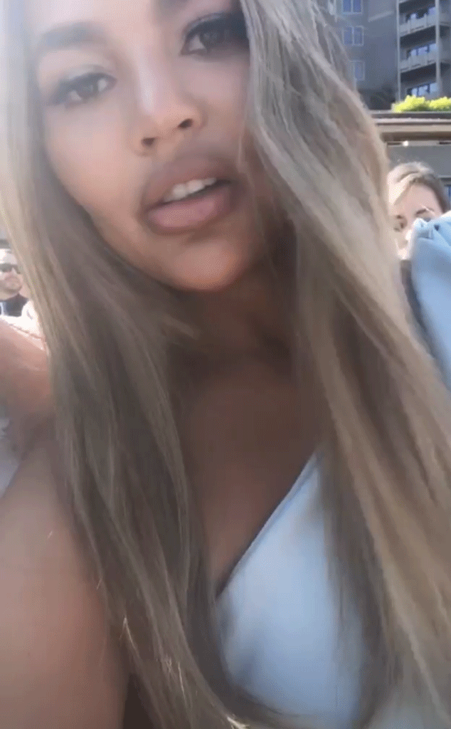 Chrissy Teigen Shows Off Swollen Lips After Getting A Crazy Reaction E Online