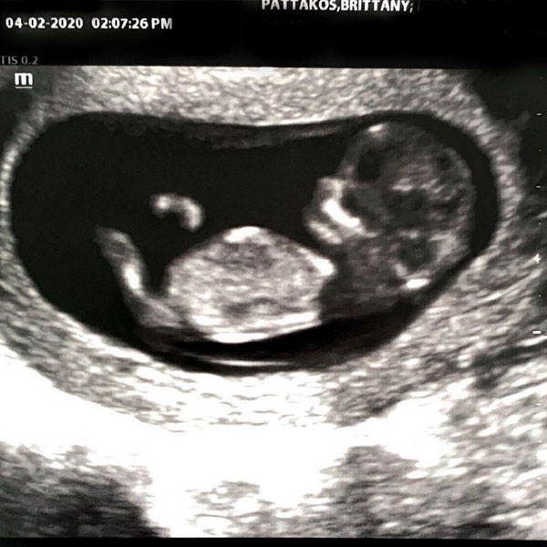 Celebrate Brittany Paul Nassif S Pregnancy By Reliving Their Romance E Online