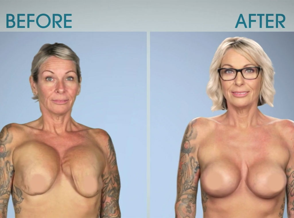 Photos from Botched Patients Before and After Shocking