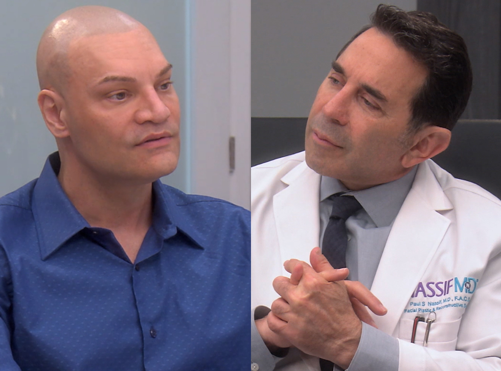 Dr Paul Nassif Takes On A Boxers Knocked Out Nose Hear All About The Botched Case E Online